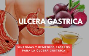 Síntomas y remedios caseros para la Úlcera Gástrica