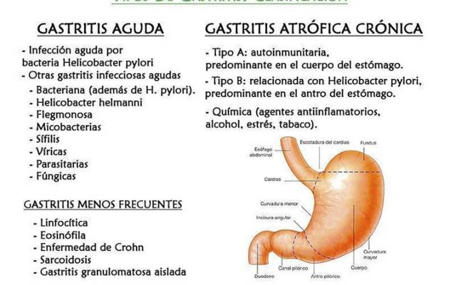 tipos de gastritis