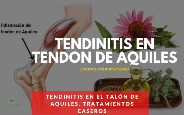 Tendinitis en el Talón de Aquiles. Tratamientos Caseros